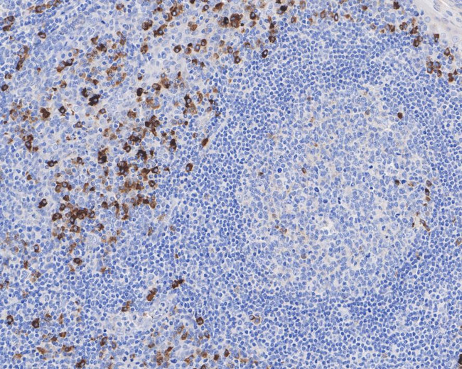 Kappa Light Chain Antibody in Immunohistochemistry (Paraffin) (IHC (P))