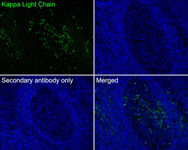 Kappa Light Chain Antibody in Immunohistochemistry (Paraffin) (IHC (P))