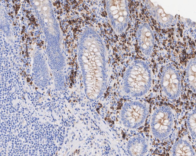 Kappa Light Chain Antibody in Immunohistochemistry (Paraffin) (IHC (P))