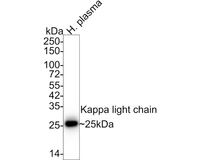 Kappa Light Chain Antibody in Western Blot (WB)