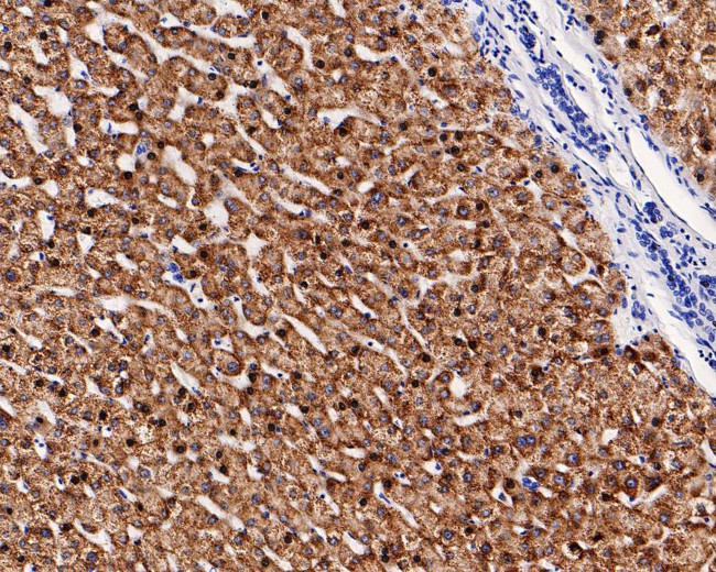 ACSL1 Antibody in Immunohistochemistry (Paraffin) (IHC (P))