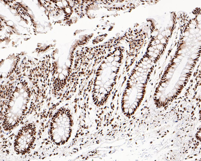 WDR41 Antibody in Immunohistochemistry (Paraffin) (IHC (P))