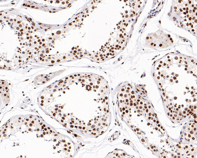 WDR41 Antibody in Immunohistochemistry (Paraffin) (IHC (P))