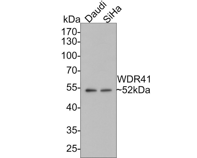 WDR41 Antibody in Western Blot (WB)