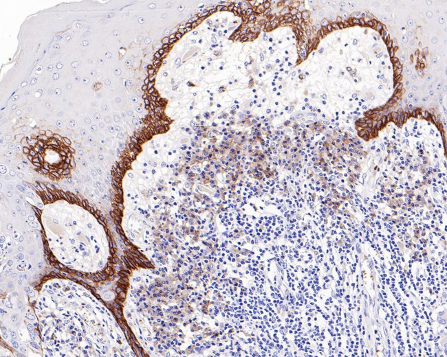 CD98 Antibody in Immunohistochemistry (Paraffin) (IHC (P))