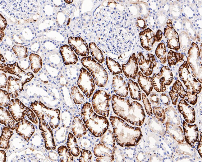 CD98 Antibody in Immunohistochemistry (Paraffin) (IHC (P))