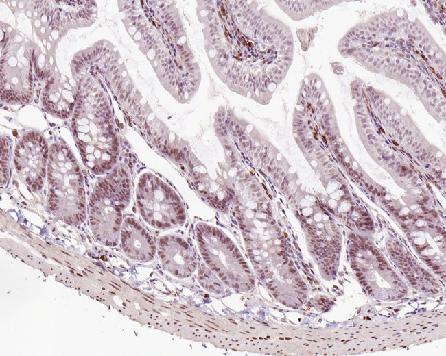 MLH1 Antibody in Immunohistochemistry (Paraffin) (IHC (P))