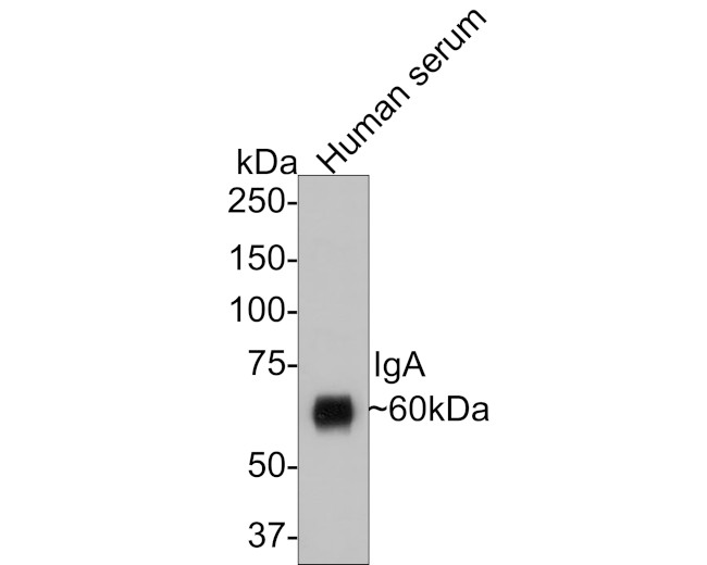 Human IgA Antibody in Western Blot (WB)