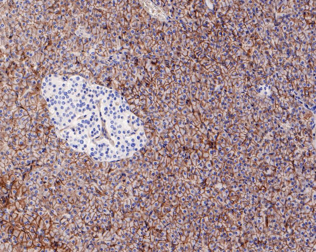 SLC7A11 Antibody in Immunohistochemistry (Paraffin) (IHC (P))