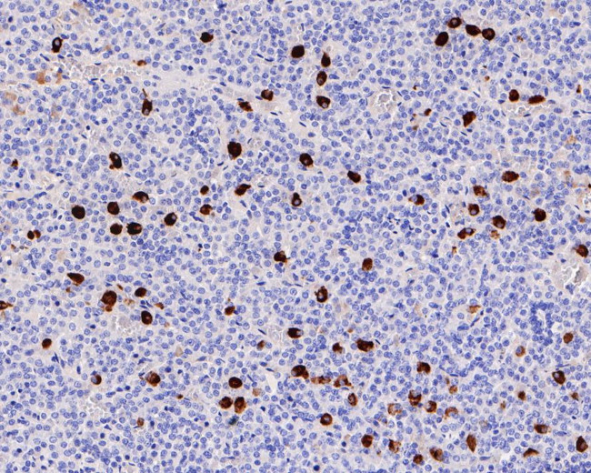 Thyroid Stimulating Hormone Antibody in Immunohistochemistry (Paraffin) (IHC (P))