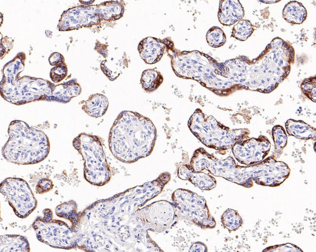 Thyroid Stimulating Hormone Antibody in Immunohistochemistry (Paraffin) (IHC (P))