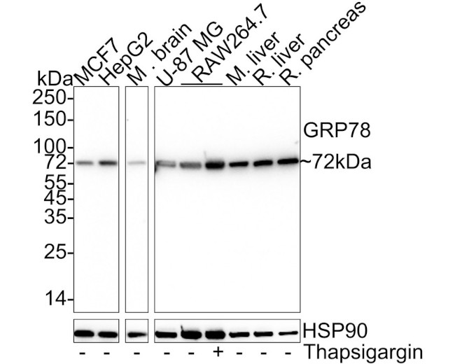 GRP78 Antibody in Western Blot (WB)