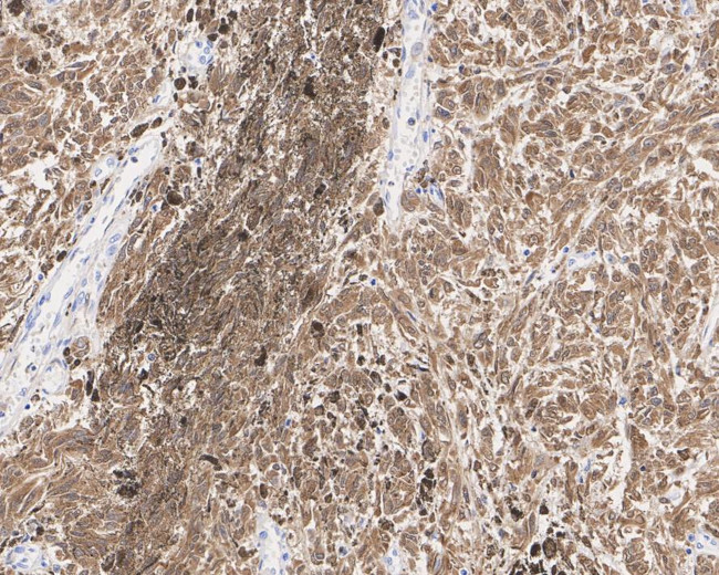 S100B Antibody in Immunohistochemistry (Paraffin) (IHC (P))