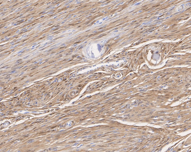 S100B Antibody in Immunohistochemistry (Paraffin) (IHC (P))