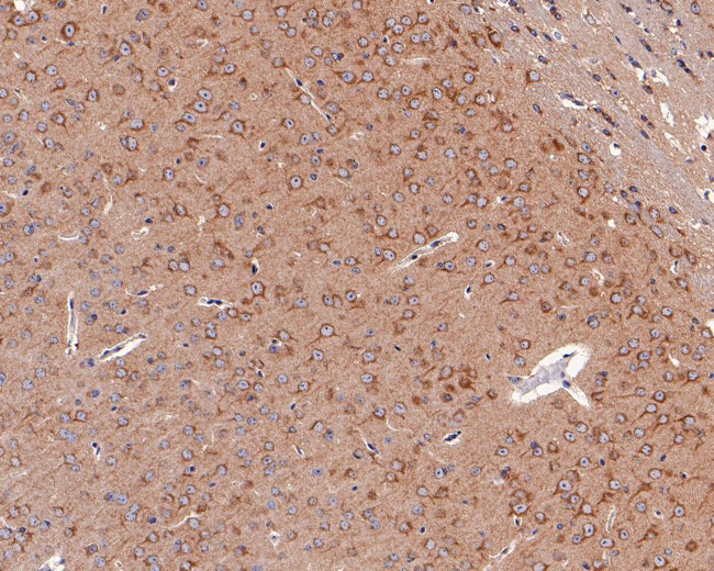 PIEZO1 Antibody in Immunohistochemistry (Paraffin) (IHC (P))