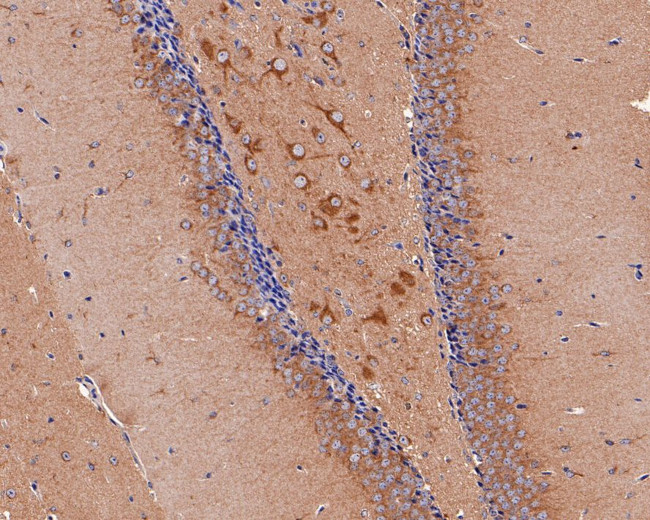 PIEZO1 Antibody in Immunohistochemistry (Paraffin) (IHC (P))