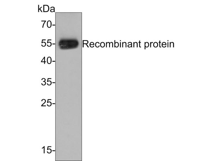 PIEZO1 Antibody in Western Blot (WB)