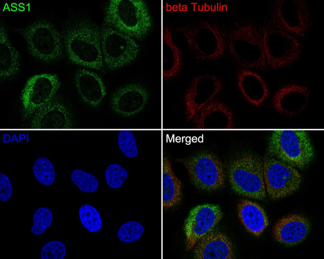 ASS1 Antibody in Immunocytochemistry (ICC/IF)