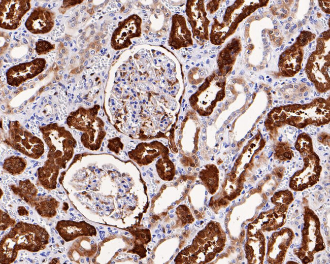 ASS1 Antibody in Immunohistochemistry (Paraffin) (IHC (P))