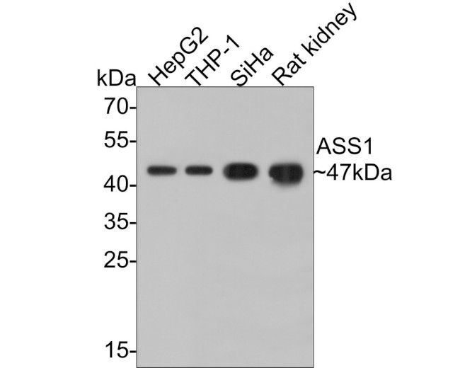 ASS1 Antibody in Western Blot (WB)