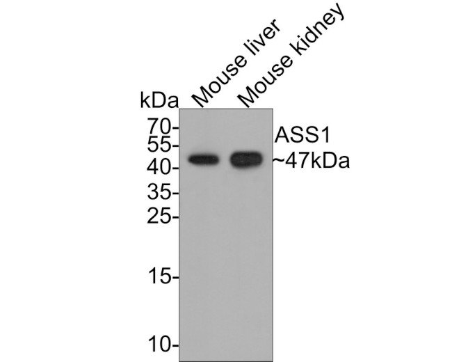 ASS1 Antibody in Western Blot (WB)