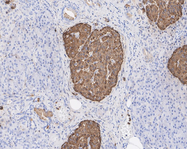 Chromogranin A Antibody in Immunohistochemistry (Paraffin) (IHC (P))