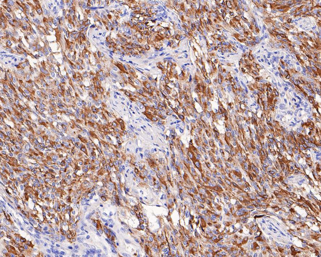 Chromogranin A Antibody in Immunohistochemistry (Paraffin) (IHC (P))