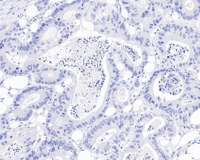 Chromogranin A Antibody in Immunohistochemistry (Paraffin) (IHC (P))