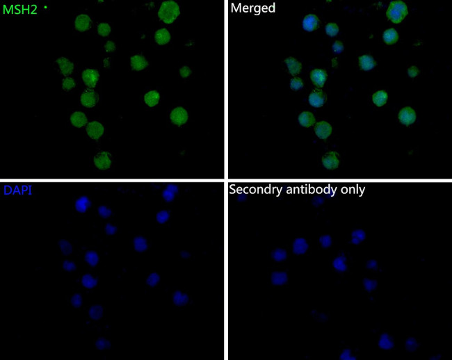 MSH2 Antibody in Immunocytochemistry (ICC/IF)