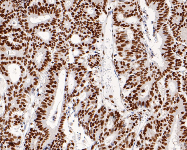 MSH2 Antibody in Immunohistochemistry (Paraffin) (IHC (P))