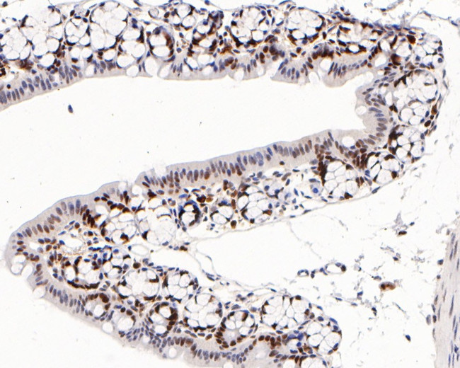 MSH2 Antibody in Immunohistochemistry (Paraffin) (IHC (P))