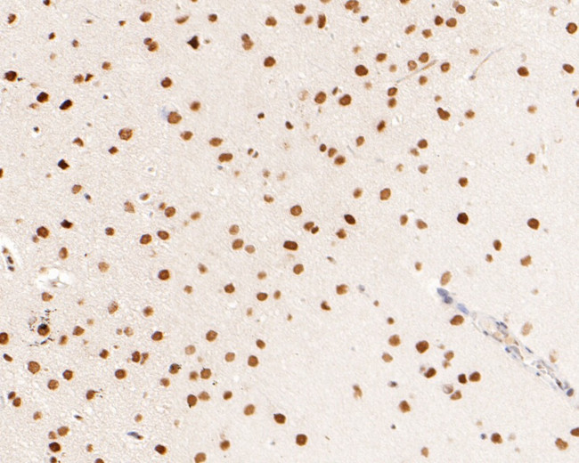 MSH2 Antibody in Immunohistochemistry (Paraffin) (IHC (P))