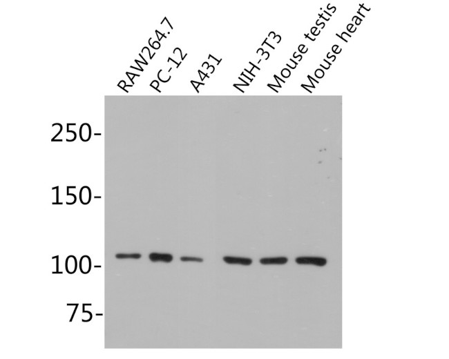 MSH2 Antibody in Western Blot (WB)