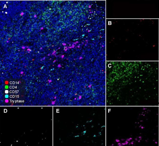 CD57 Antibody in Immunohistochemistry (Paraffin) (IHC (P))