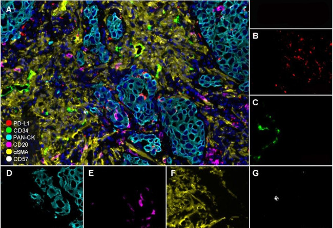 CD57 Antibody in Immunohistochemistry (Paraffin) (IHC (P))