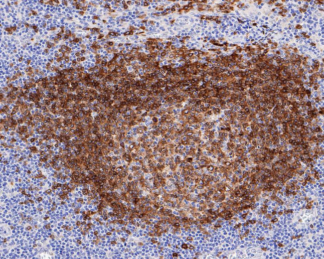 CD79a Antibody in Immunohistochemistry (Paraffin) (IHC (P))