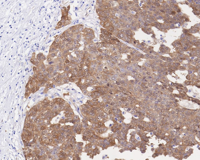 p16INK4a Antibody in Immunohistochemistry (Paraffin) (IHC (P))