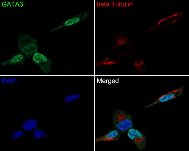 GATA3 Antibody in Immunocytochemistry (ICC/IF)