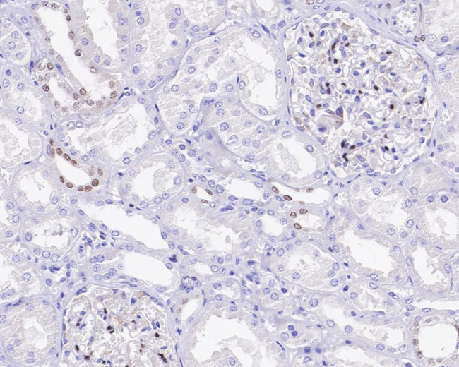 GATA3 Antibody in Immunohistochemistry (Paraffin) (IHC (P))