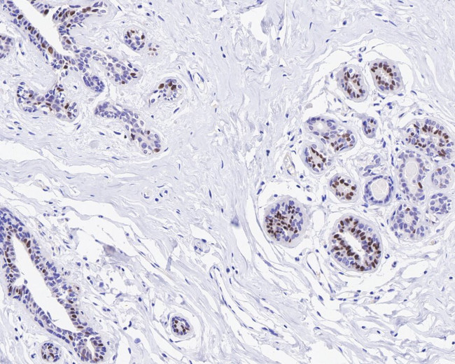 GATA3 Antibody in Immunohistochemistry (Paraffin) (IHC (P))