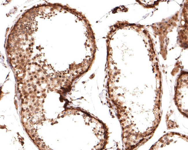 PIN4 Antibody in Immunohistochemistry (Paraffin) (IHC (P))