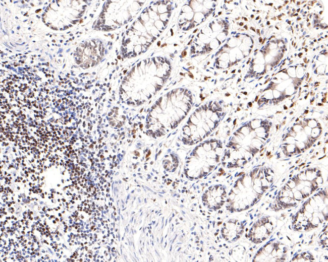 PREB Antibody in Immunohistochemistry (Paraffin) (IHC (P))