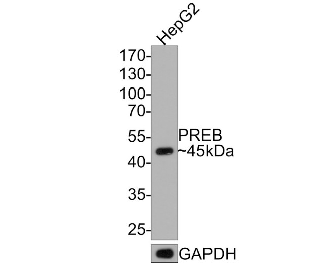 PREB Antibody in Western Blot (WB)