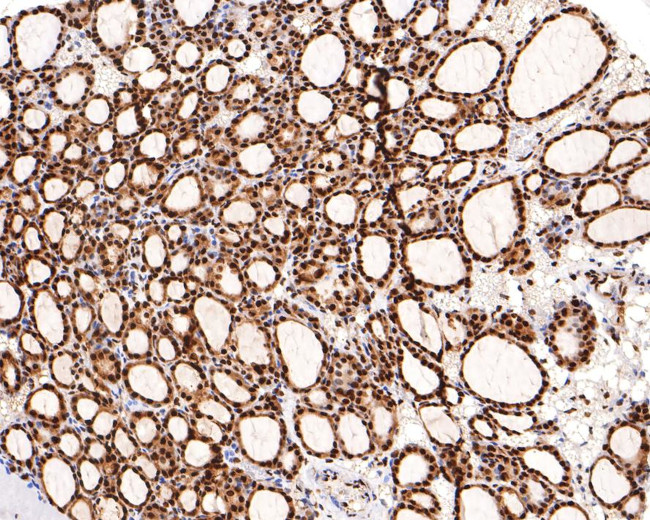 RBM3 Antibody in Immunohistochemistry (Paraffin) (IHC (P))