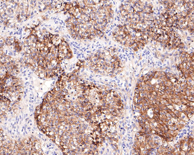 CD99 Antibody in Immunohistochemistry (Paraffin) (IHC (P))