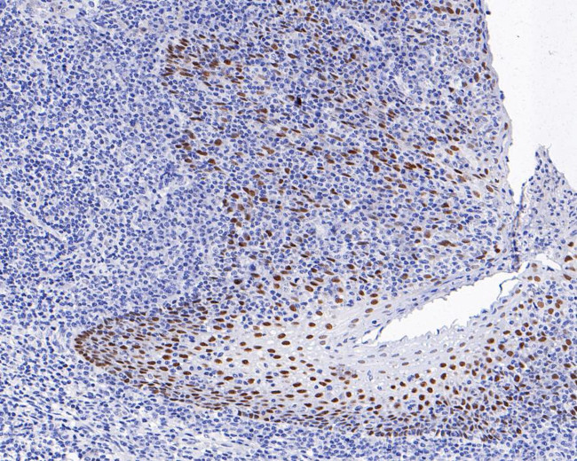 SOX2 Antibody in Immunocytochemistry (ICC/IF)