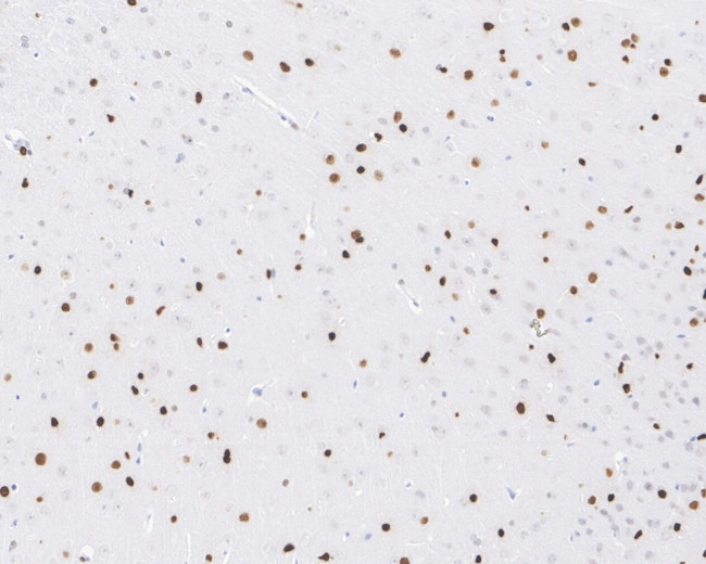 SOX2 Antibody in Immunohistochemistry (Paraffin) (IHC (P))