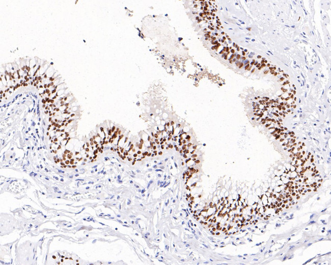 SOX2 Antibody in Immunohistochemistry (Paraffin) (IHC (P))