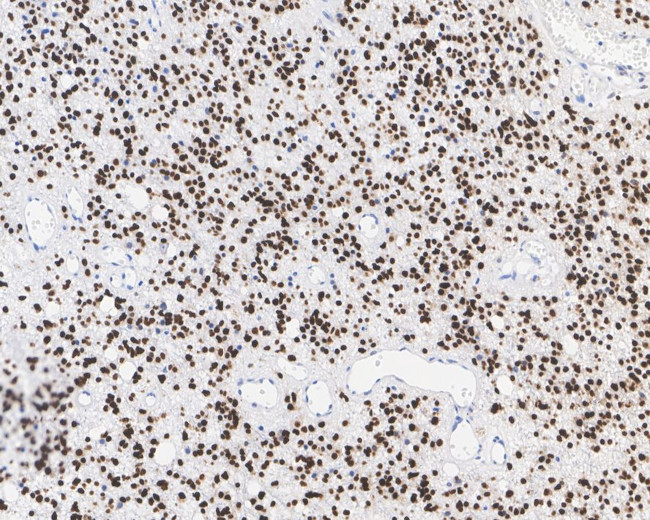 SOX2 Antibody in Immunohistochemistry (Paraffin) (IHC (P))