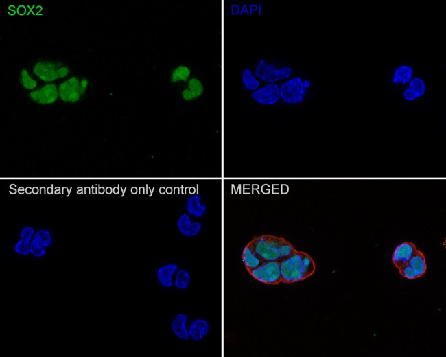 SOX2 Antibody in Immunohistochemistry (Paraffin) (IHC (P))